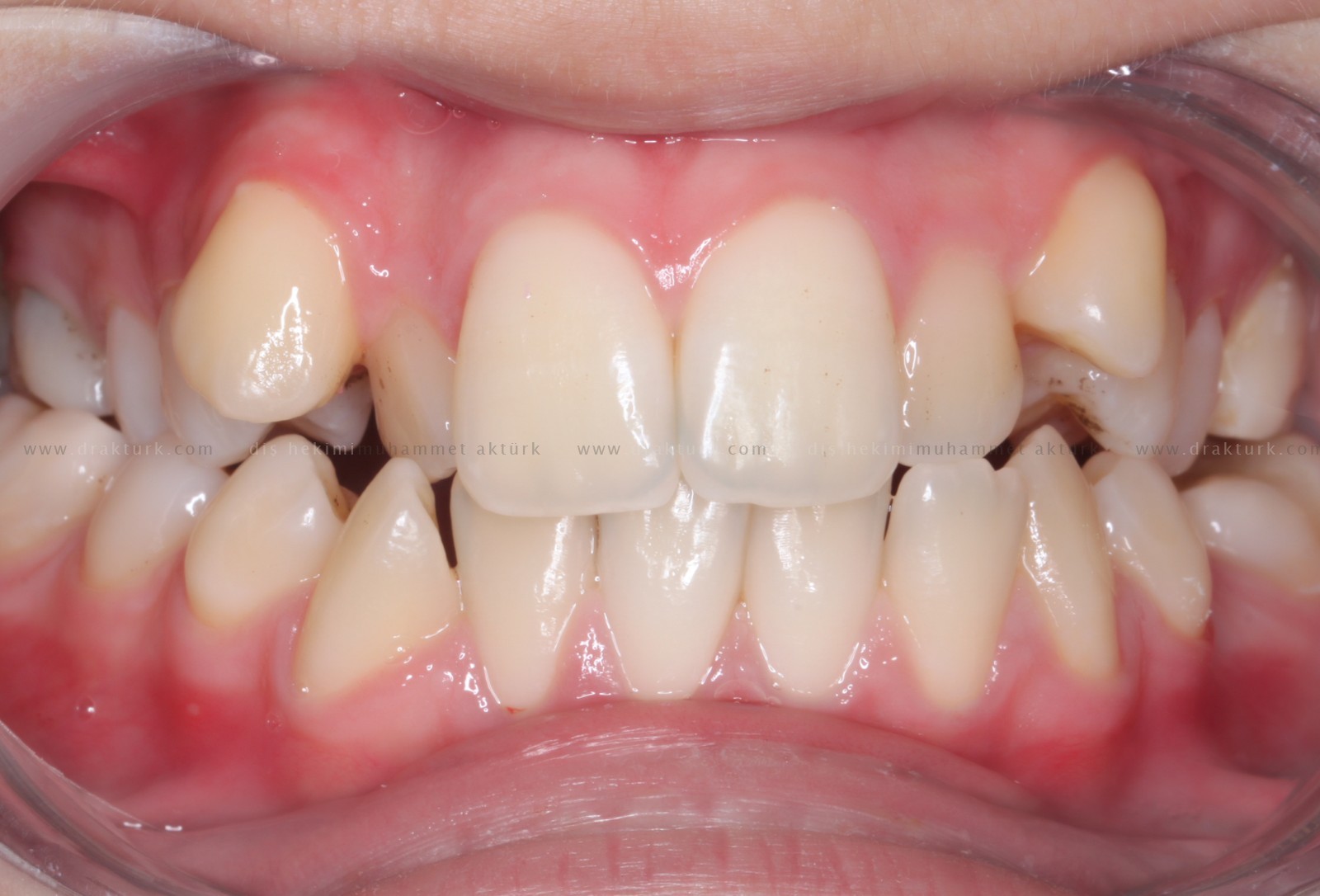 Muhammet Akturk - Dentist - Trabzon - Turkey Muhammet Akturk - Dentist - Trabzon - Turkey