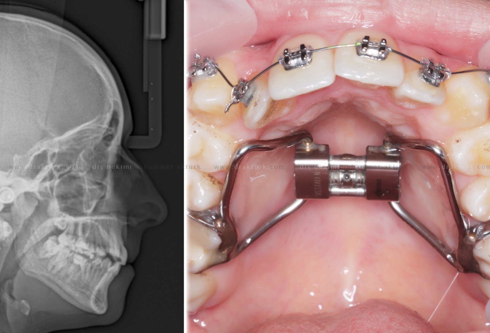 Muhammet Akturk - Dentist - Trabzon - Turkey Muhammet Akturk - Dentist - Trabzon - Turkey