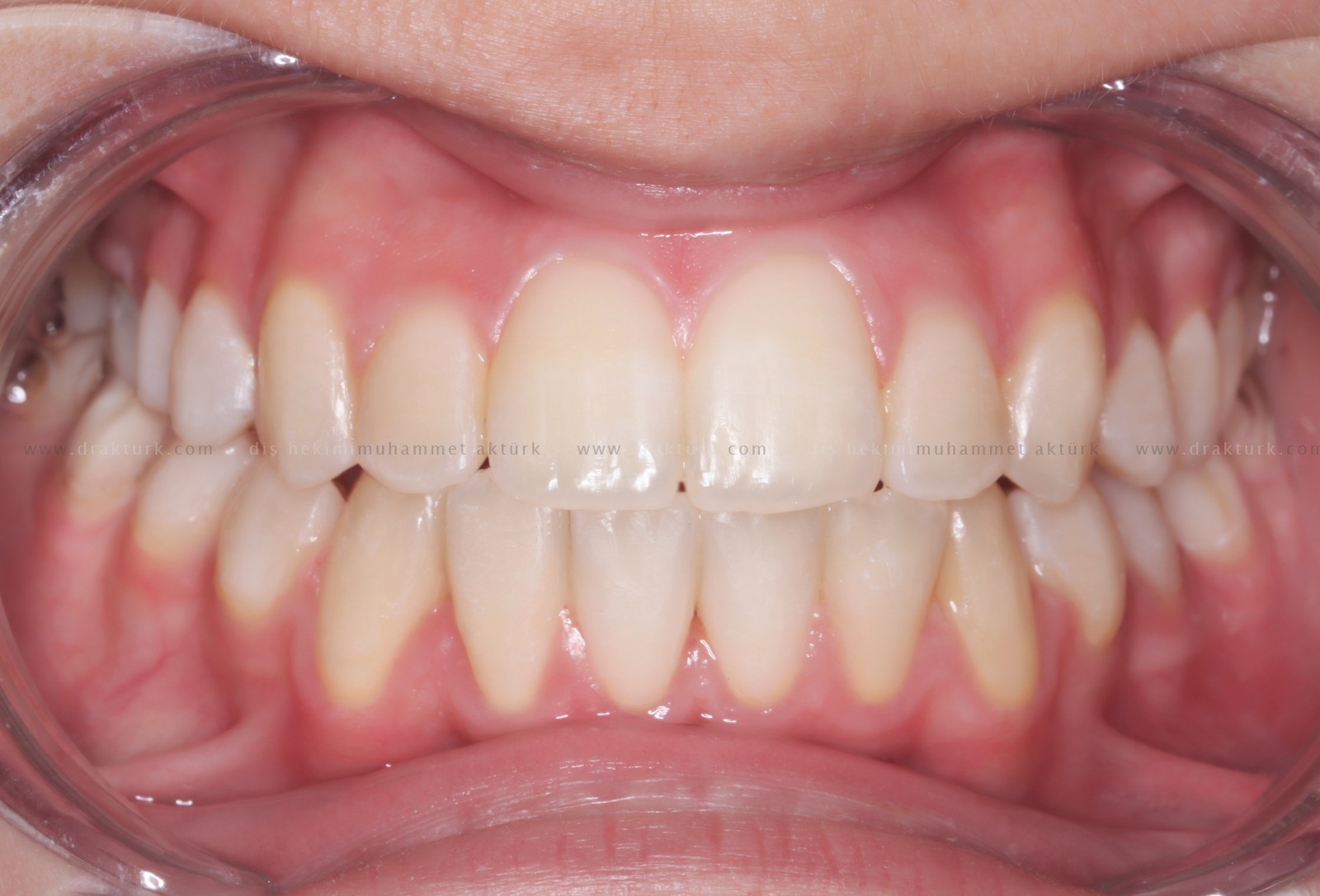 Muhammet Akturk - Dentist - Trabzon - Turkey Muhammet Akturk - Dentist - Trabzon - Turkey